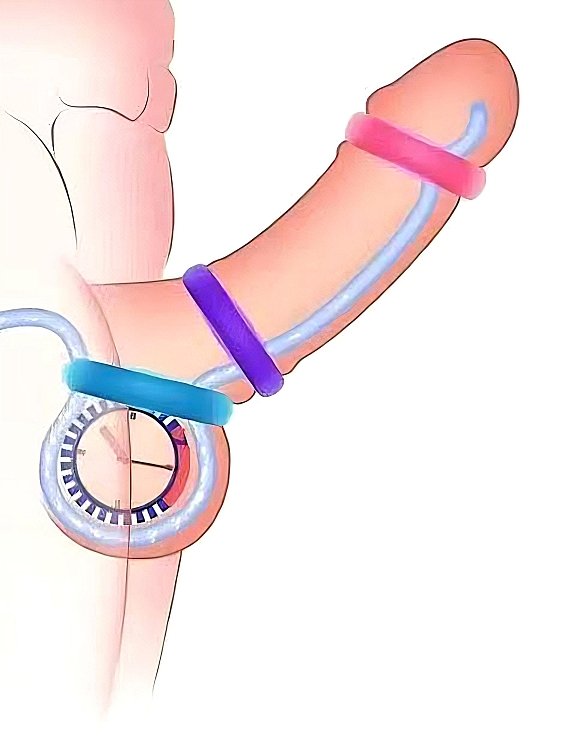 SMD Stay Hard Penis Rings Set, Comfort Fit Δαχτυλίδια Στύσης Σιλικόνης, 3τμχ